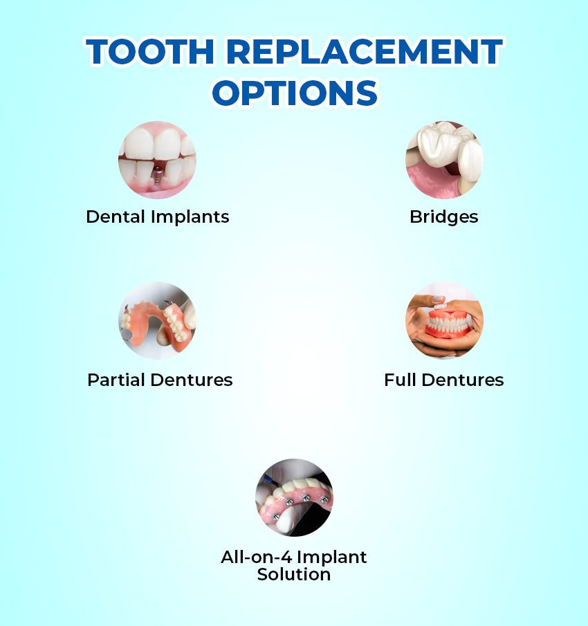 Tooth Replacement 